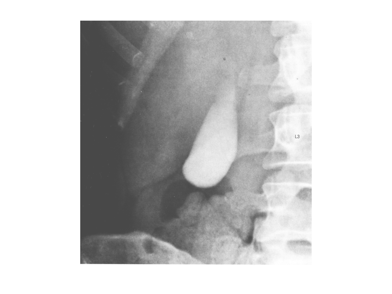 Abdomen gros intestin foie rate pancreas vascularisation page 52