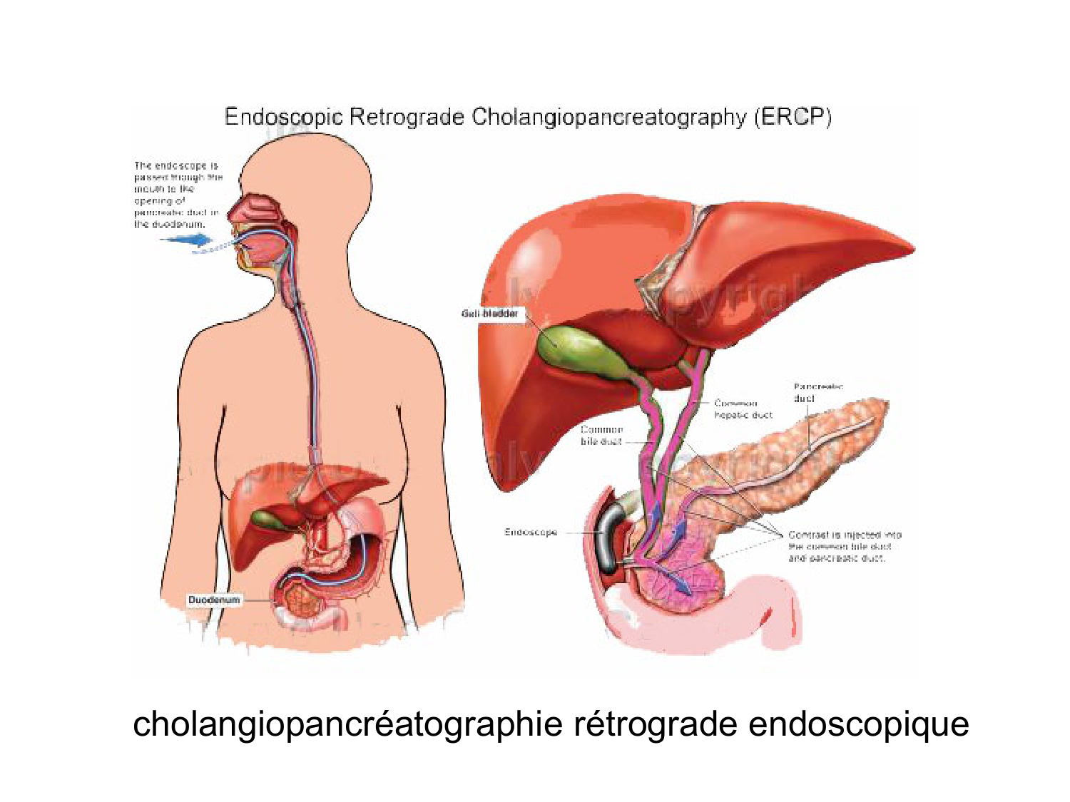 Abdomen gros intestin foie rate pancreas vascularisation page 53
