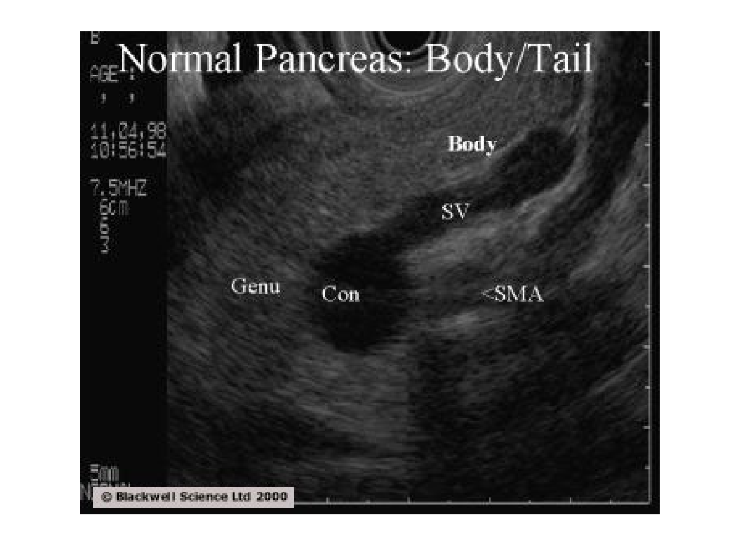 Abdomen gros intestin foie rate pancreas vascularisation page 59
