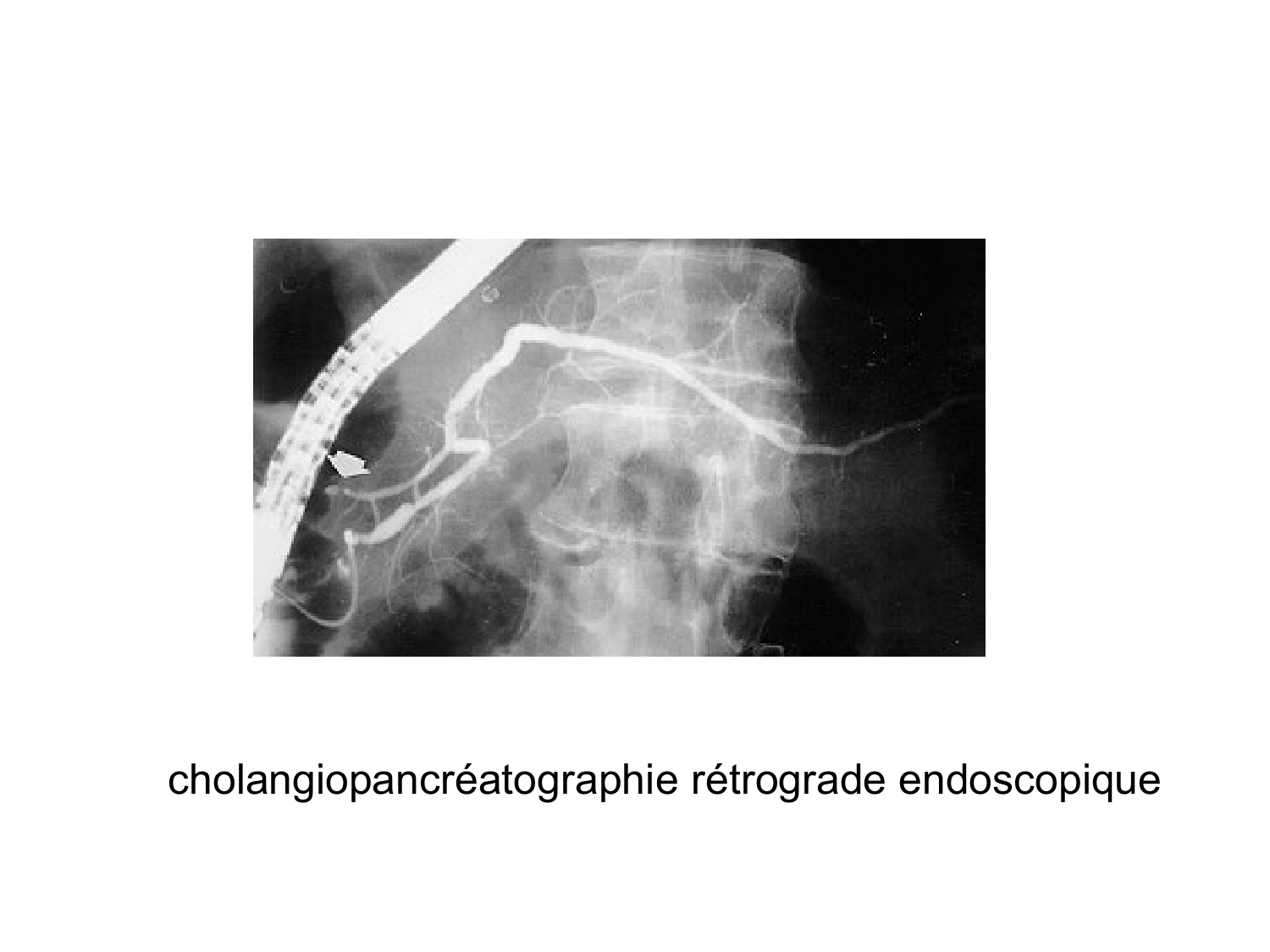 Abdomen gros intestin foie rate pancreas vascularisation page 61