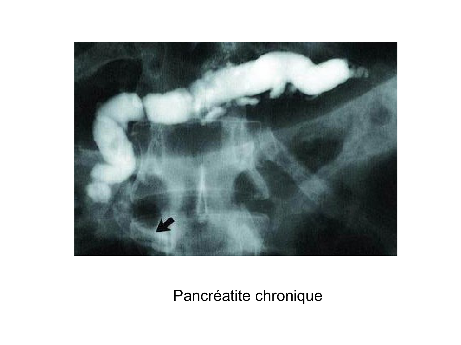 Abdomen gros intestin foie rate pancreas vascularisation page 63