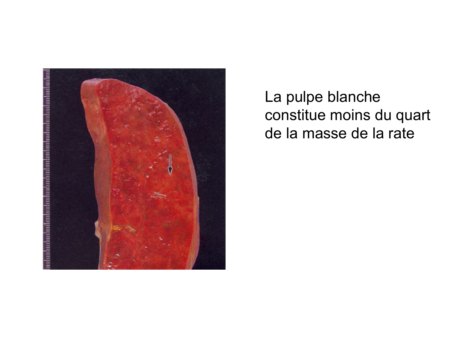 Abdomen gros intestin foie rate pancreas vascularisation page 69