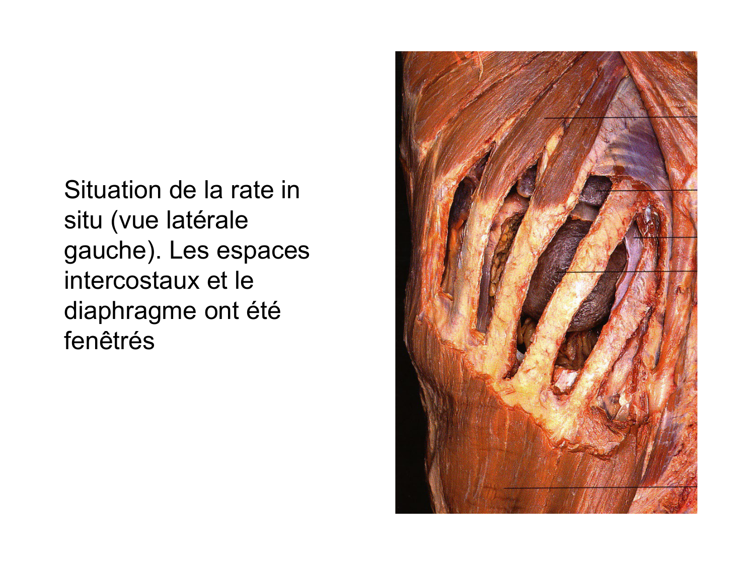 Abdomen gros intestin foie rate pancreas vascularisation page 70