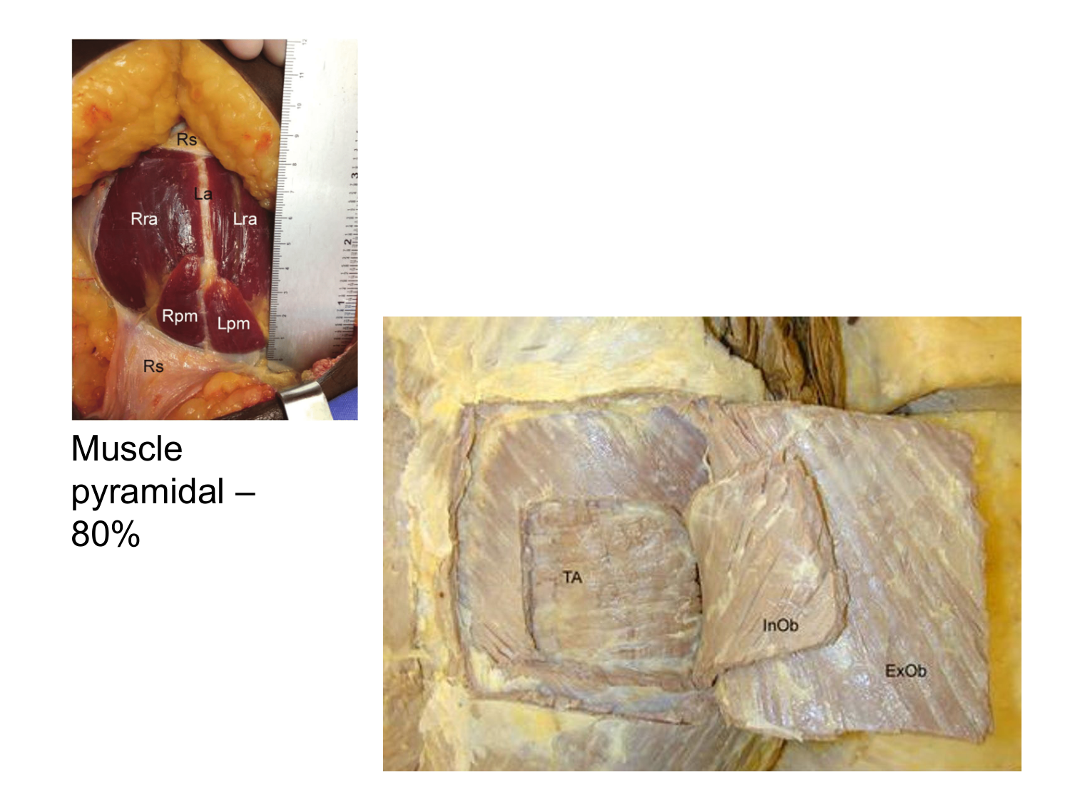 Abdomen paroi cavité tube digestif estomac et intestin grêle page 9