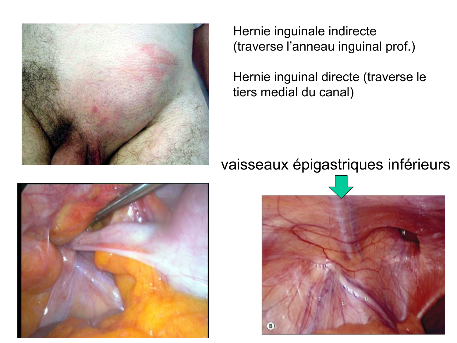 Abdomen paroi cavité tube digestif estomac et intestin grêle page 15