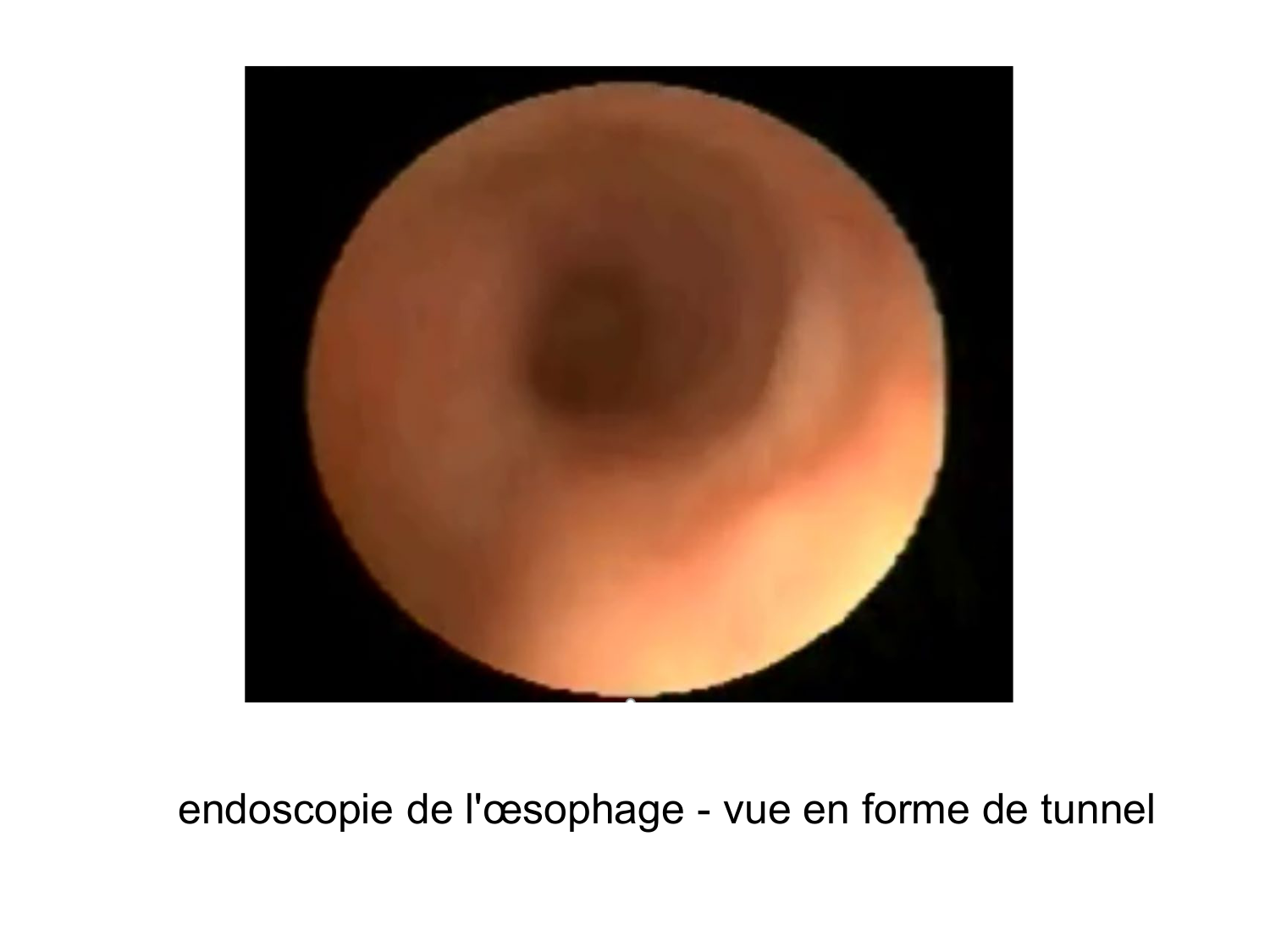 Abdomen paroi cavité tube digestif estomac et intestin grêle page 21