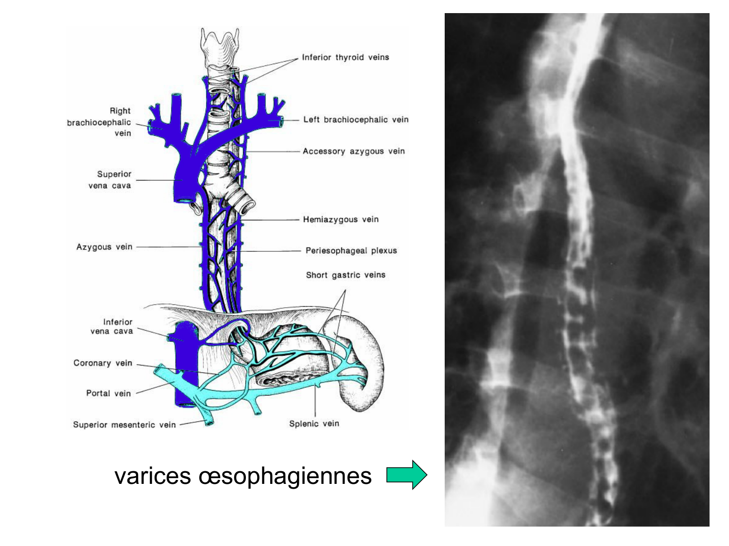 Abdomen paroi cavité tube digestif estomac et intestin grêle page 22