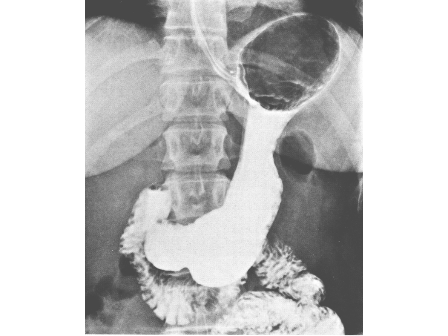 Abdomen paroi cavité tube digestif estomac et intestin grêle page 31