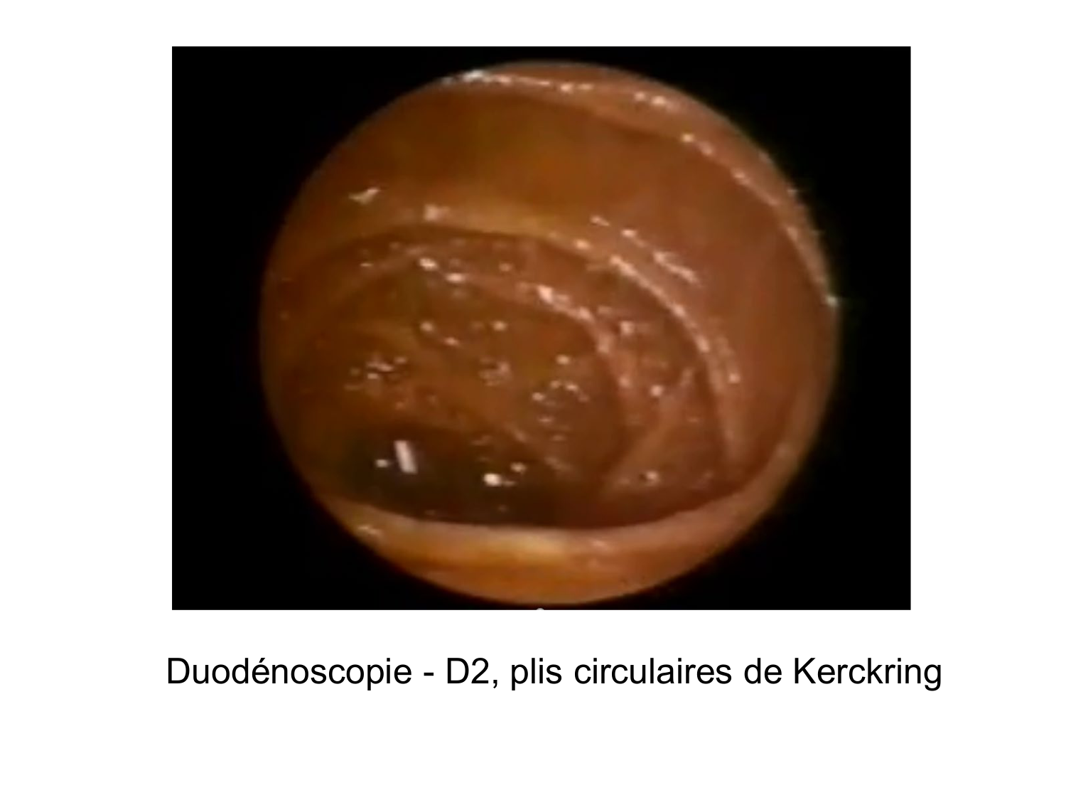 Abdomen paroi cavité tube digestif estomac et intestin grêle page 39