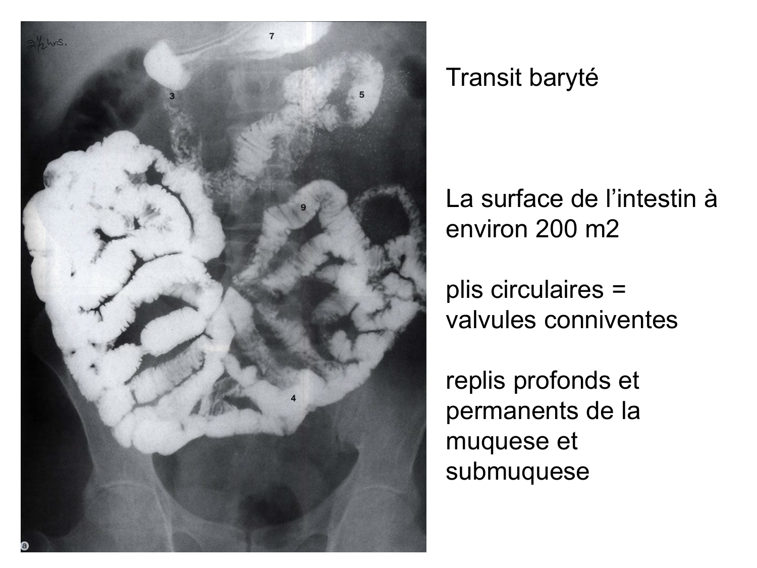 Abdomen paroi cavité tube digestif estomac et intestin grêle page 46