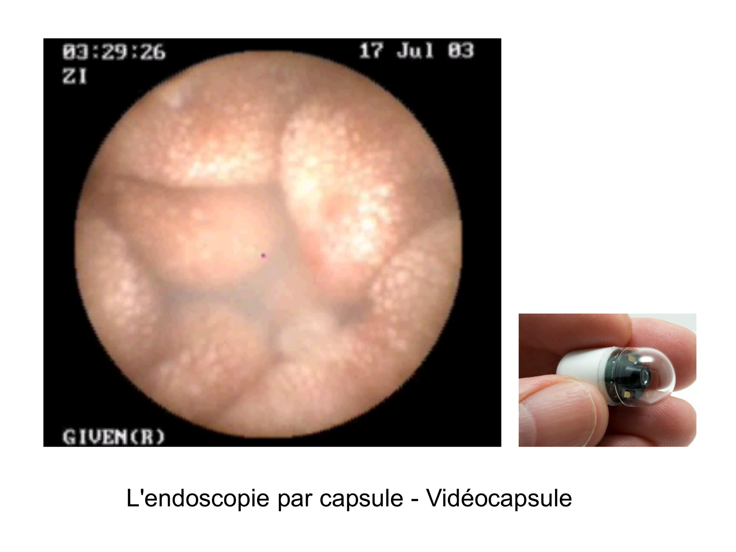 Abdomen paroi cavité tube digestif estomac et intestin grêle page 48