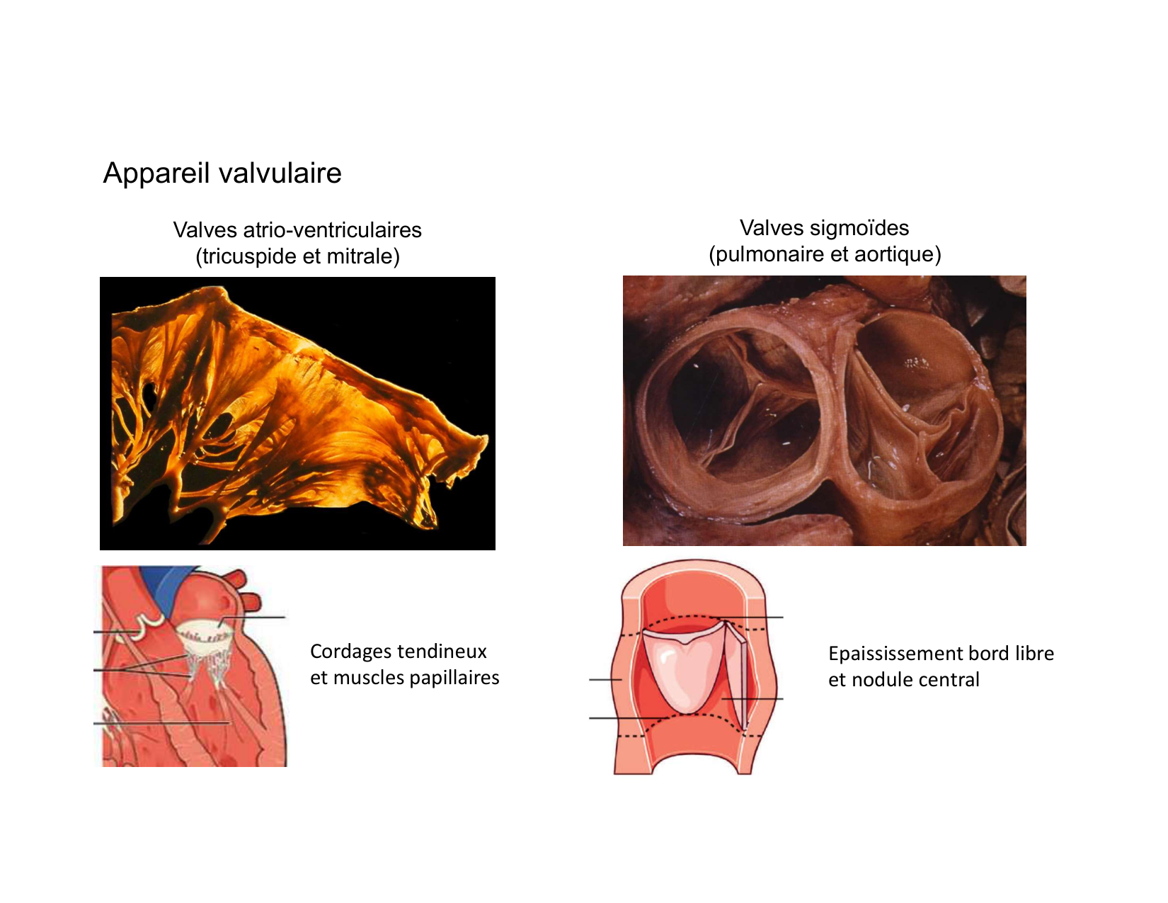 Anatomie du mediastin 2025 2026 page 34