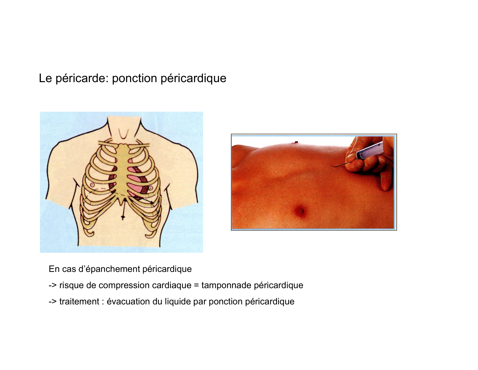 Anatomie du mediastin 2025 2026 page 49