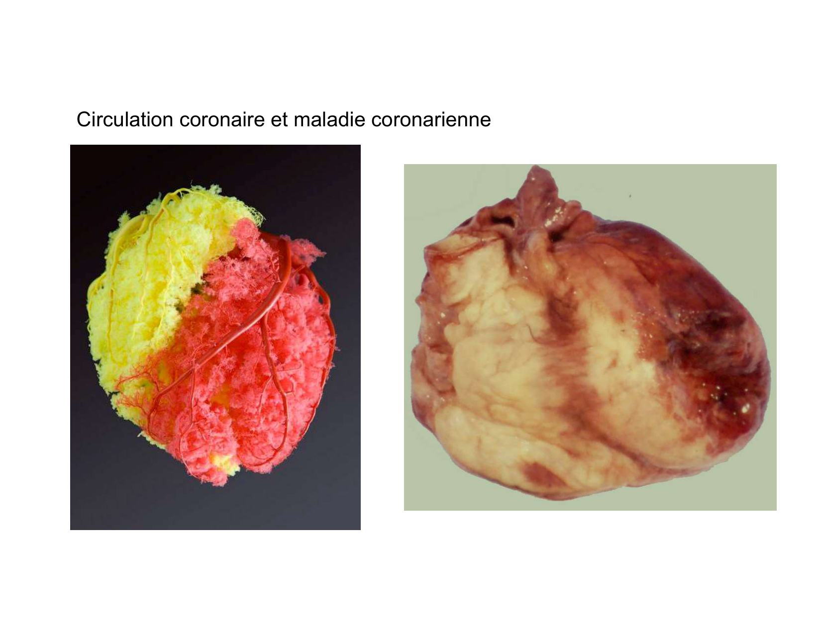 Anatomie du mediastin 2025 2026 page 55