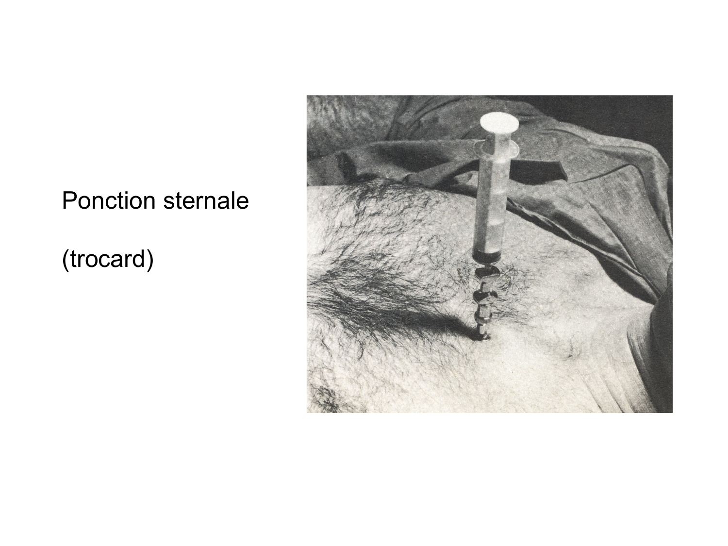 Anatomie du système de défense2 page 9