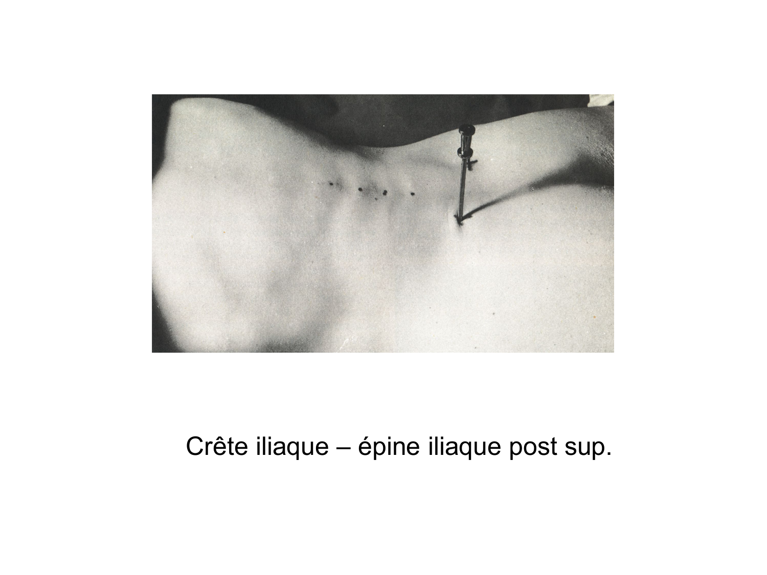 Anatomie du système de défense2 page 10