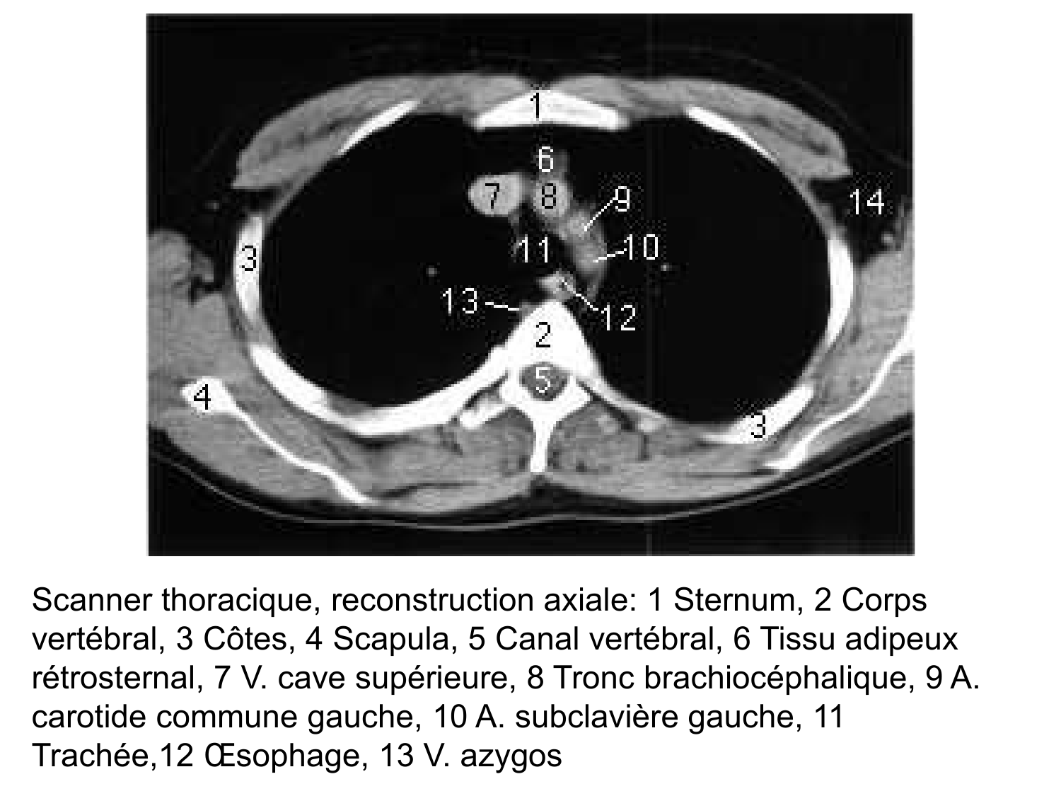 Anatomie du système de défense2 page 12