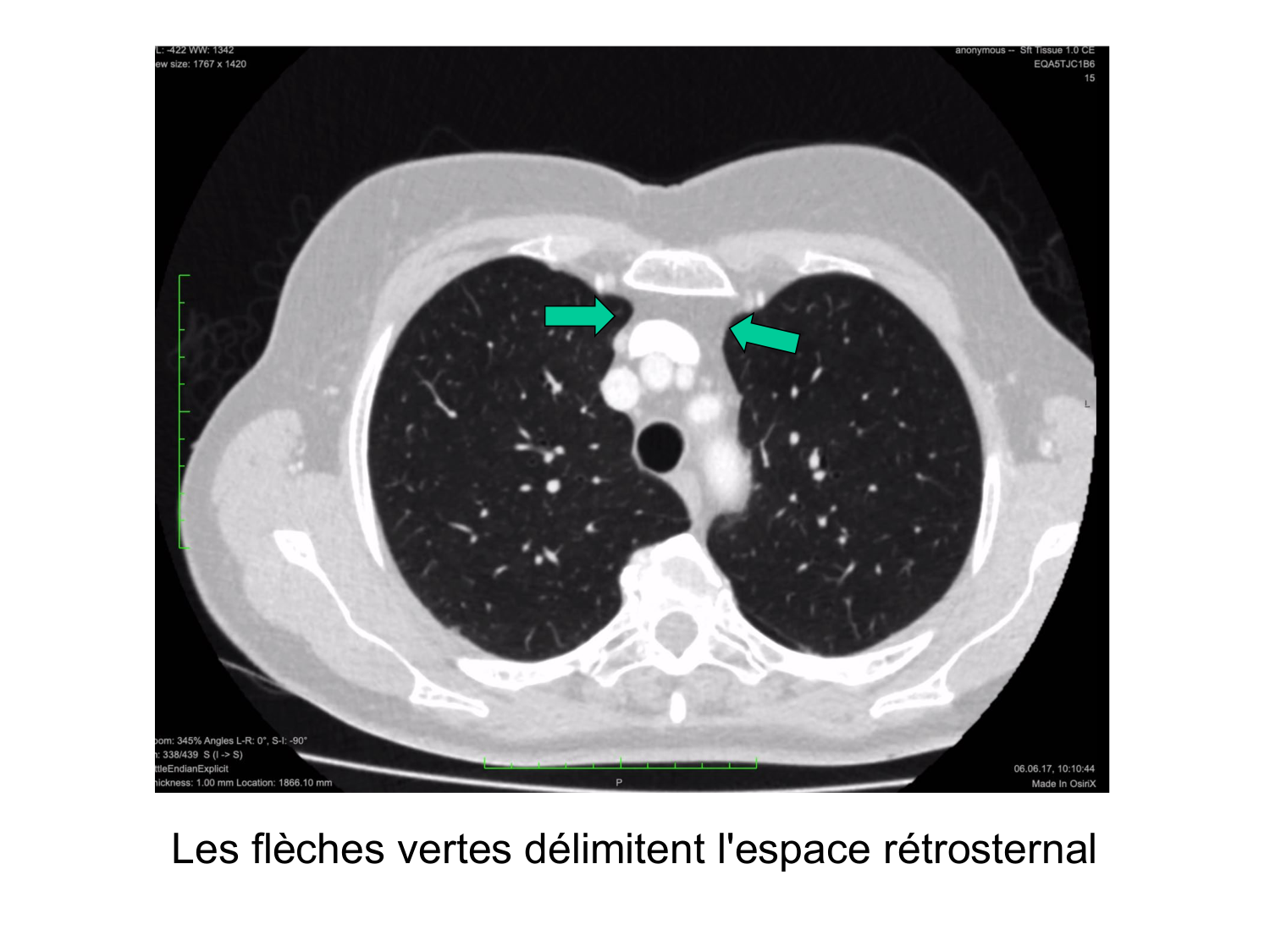 Anatomie du système de défense2 page 13