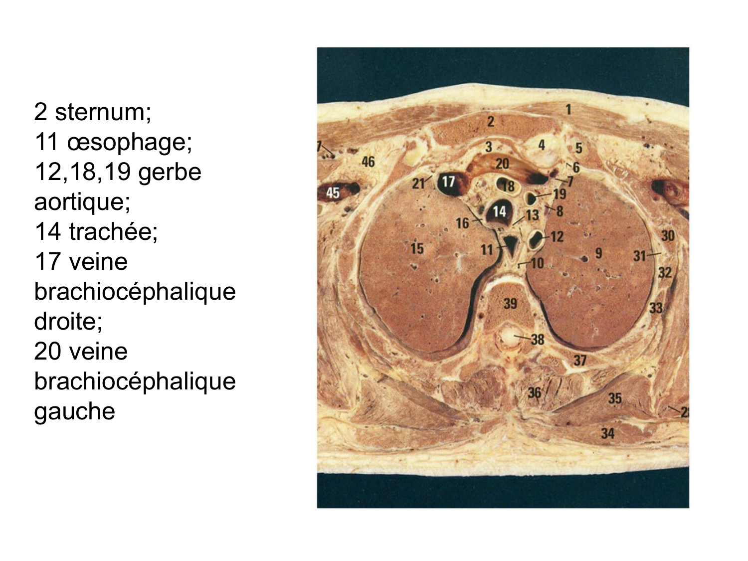 Anatomie du système de défense2 page 14