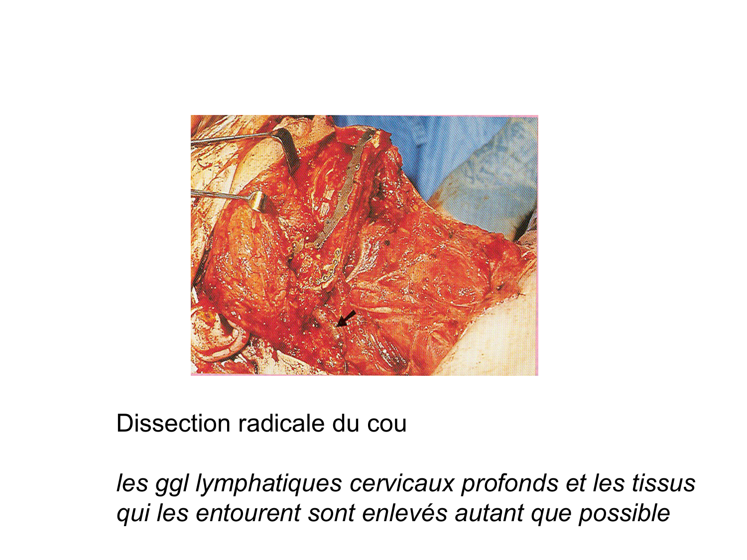 Anatomie du système de défense2 page 28