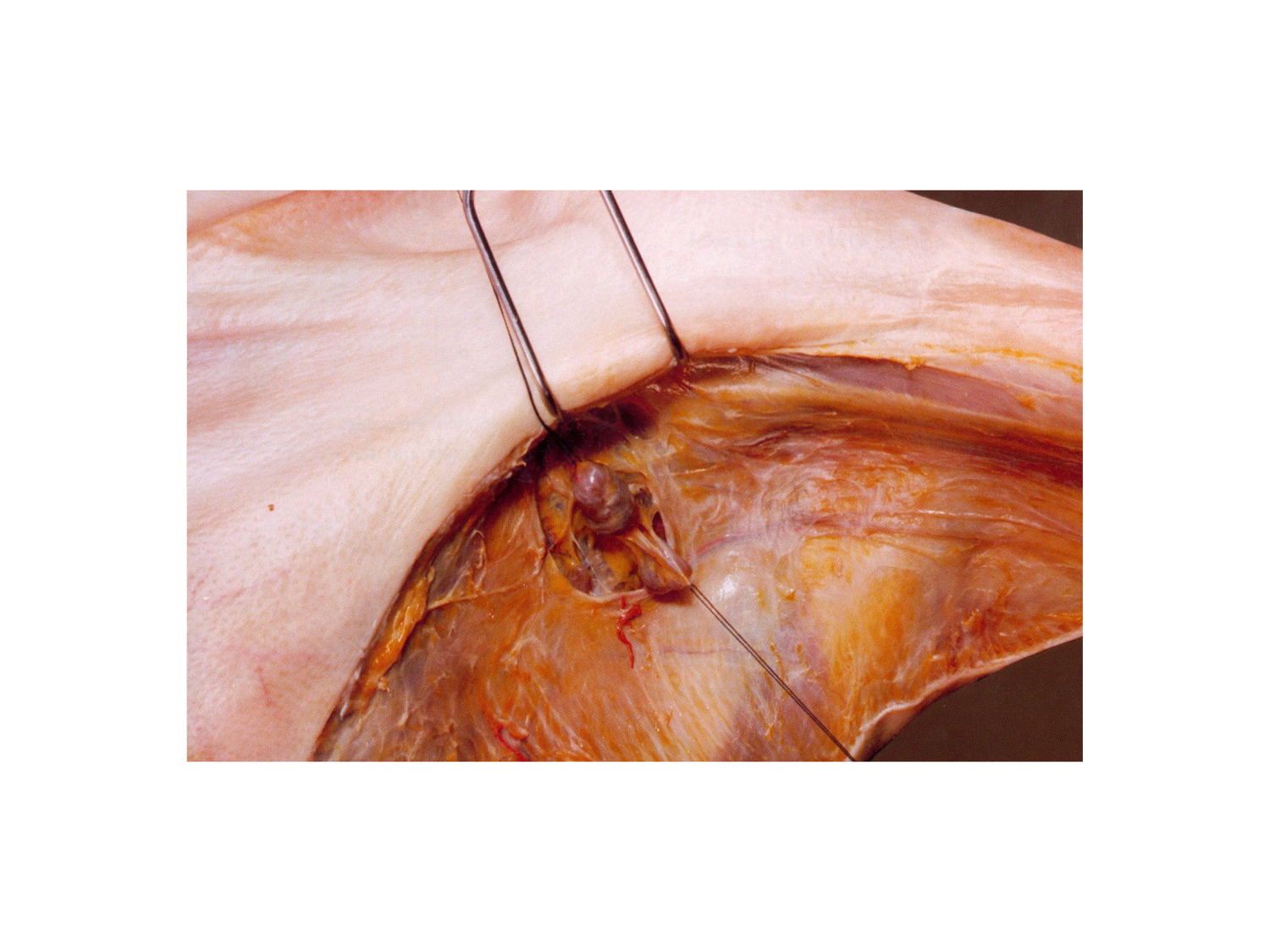 Anatomie du système de défense2 page 30