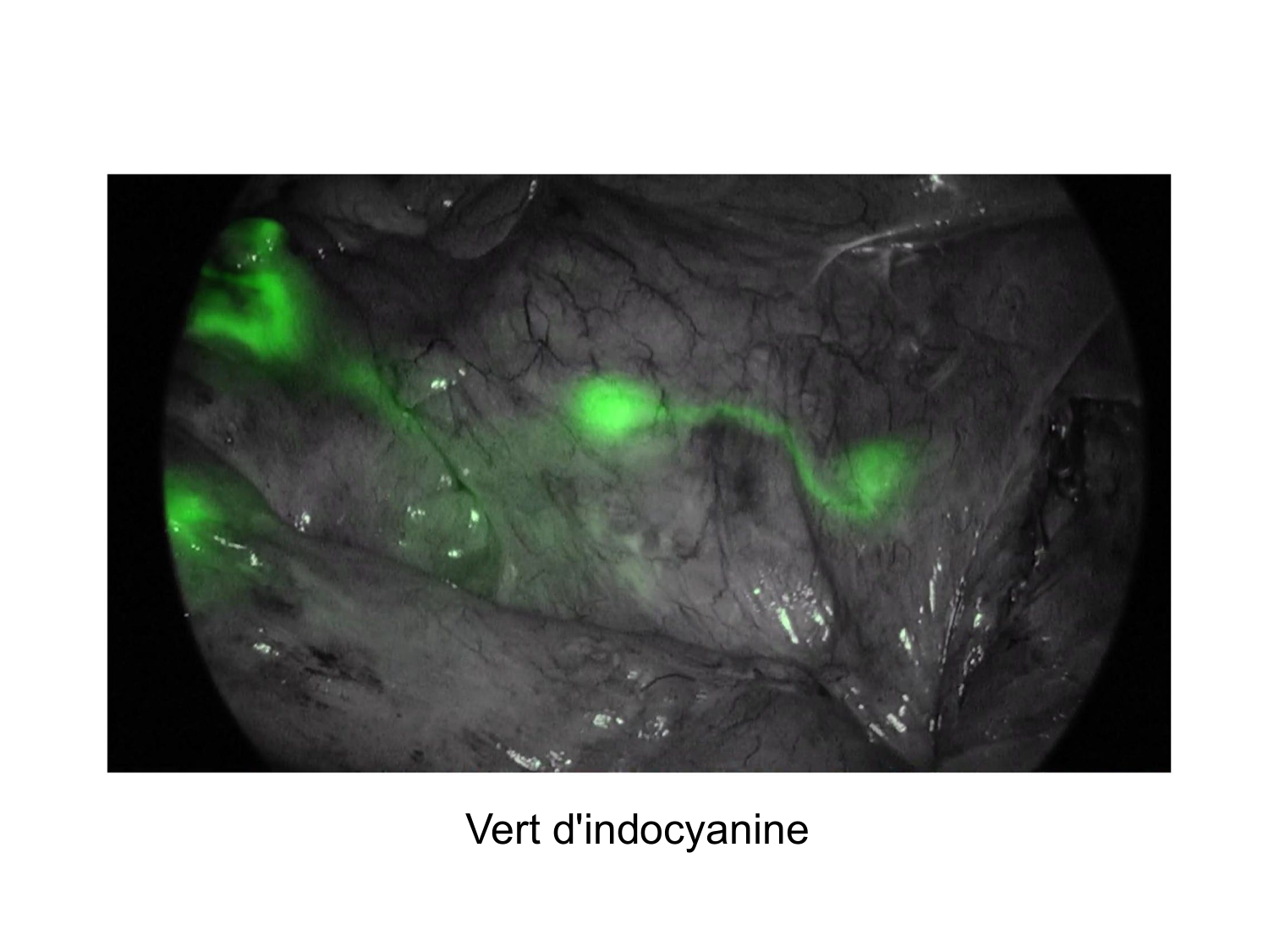 Anatomie du système de défense2 page 42