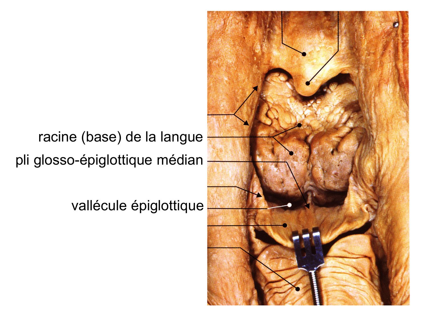 Anatomie du système de défense2 page 58