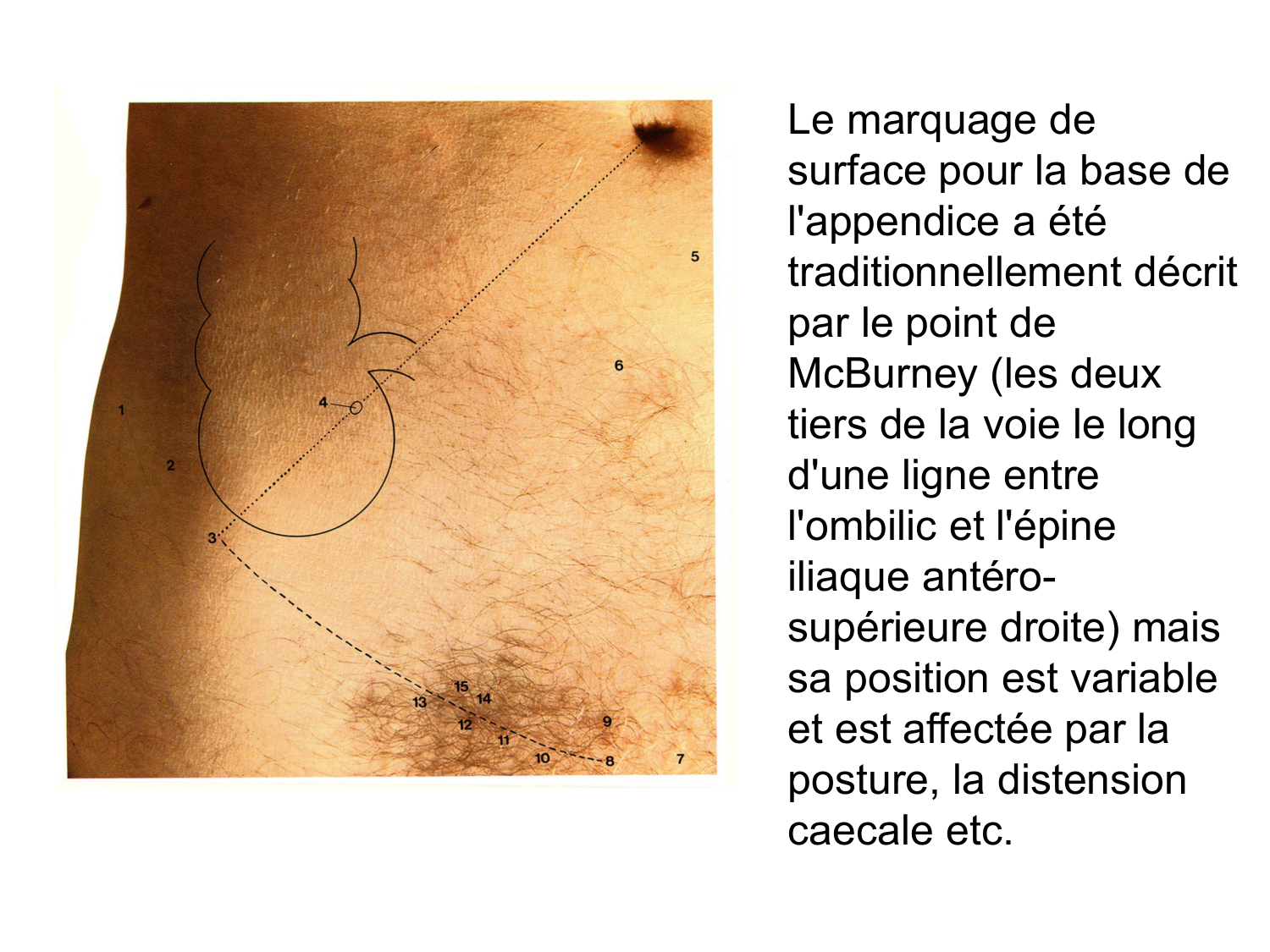 Anatomie du système de défense2 page 67