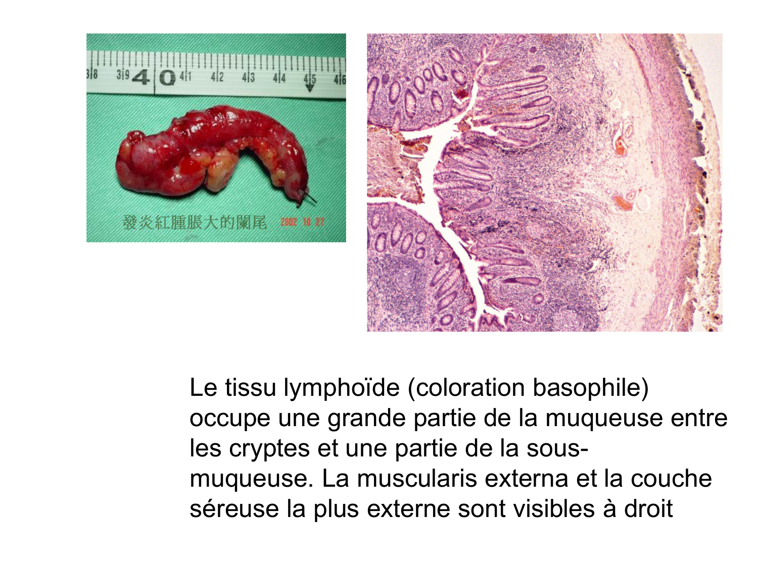 Anatomie du système de défense2 page 68