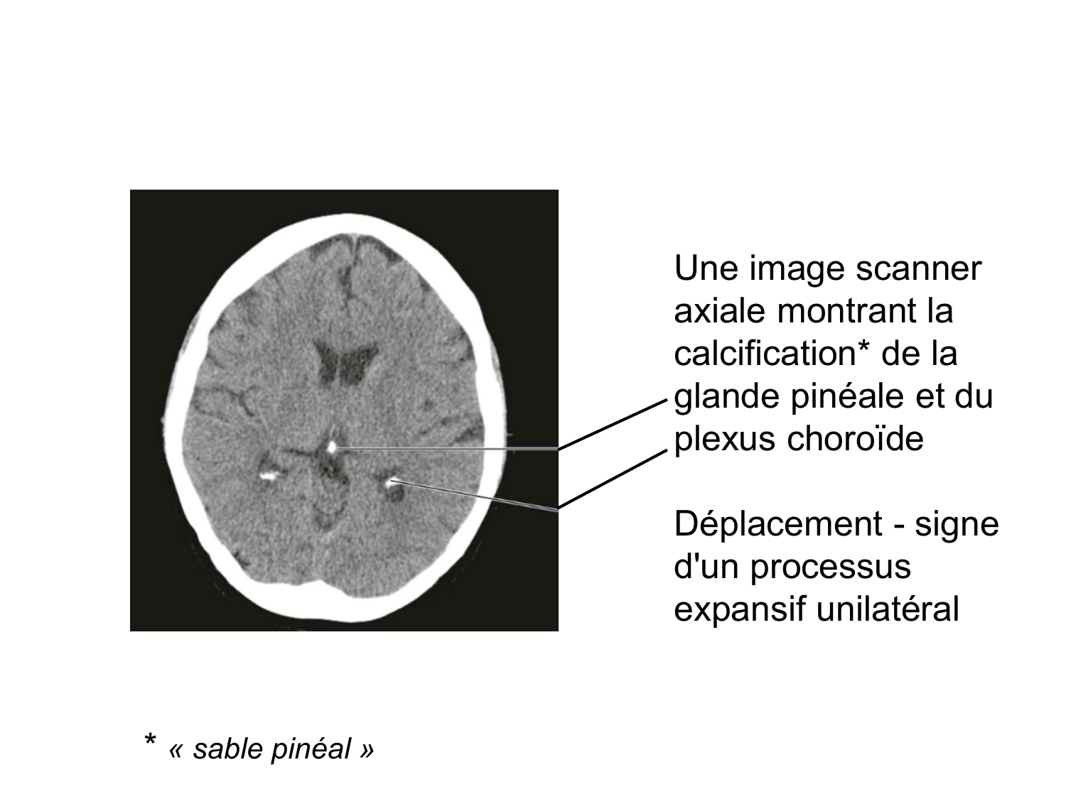 Anatomie du système endocrinien2 page 11