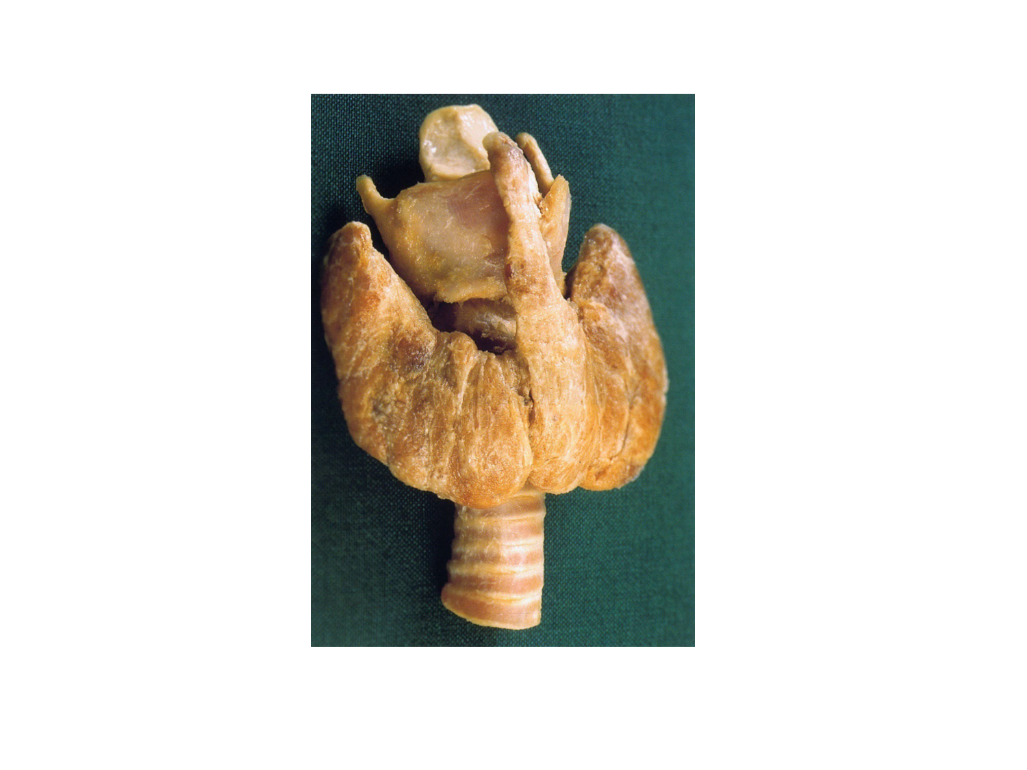 Anatomie du système endocrinien2 page 26