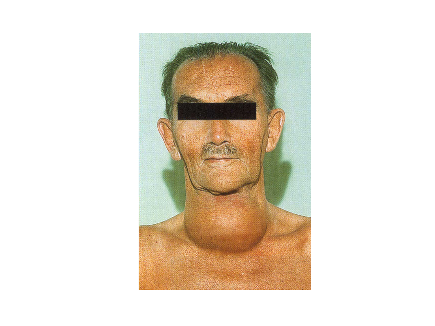 Anatomie du système endocrinien2 page 36