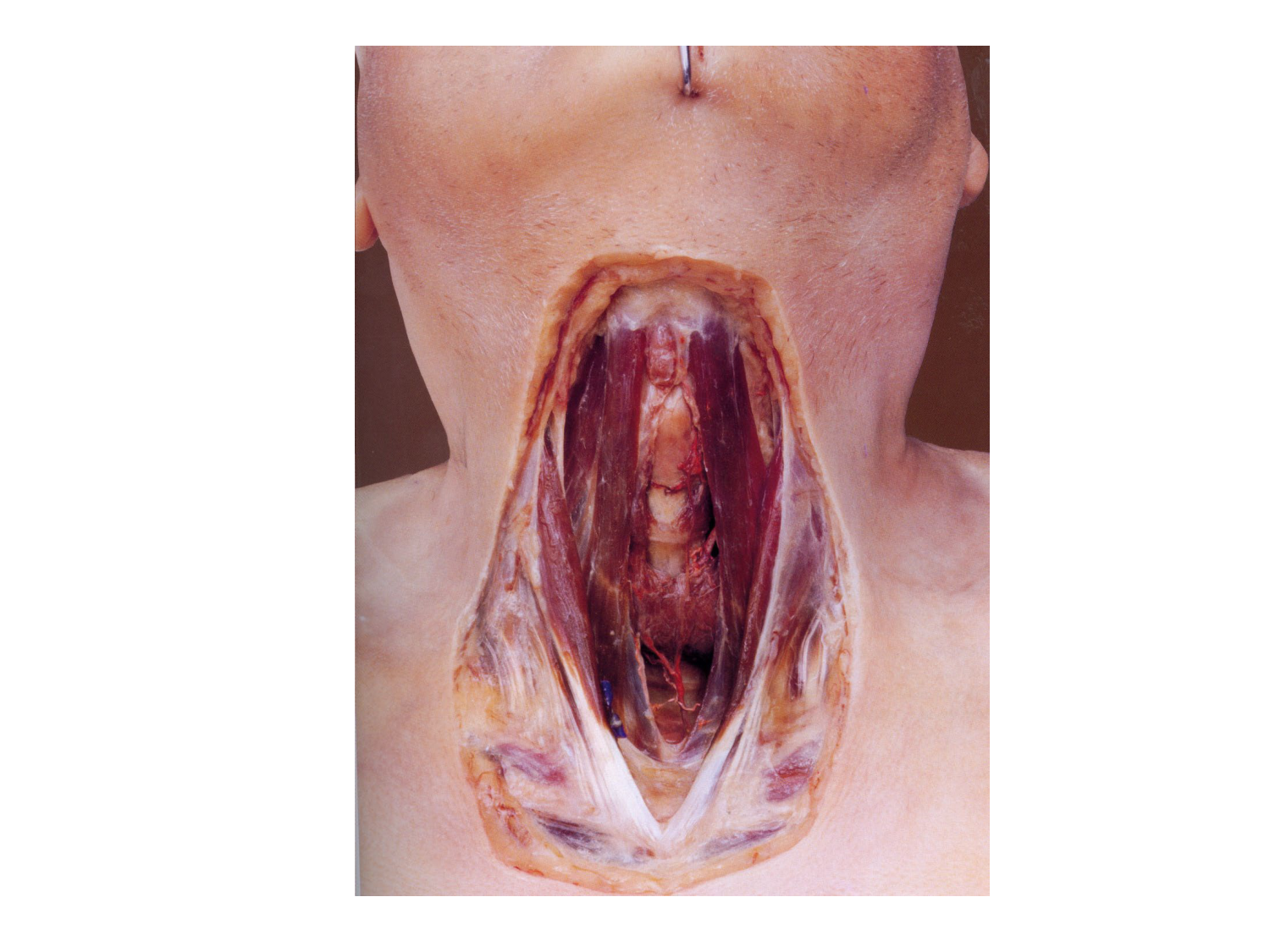 Anatomie du système endocrinien2 page 38