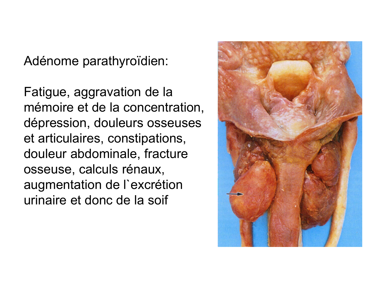 Anatomie du système endocrinien2 page 43