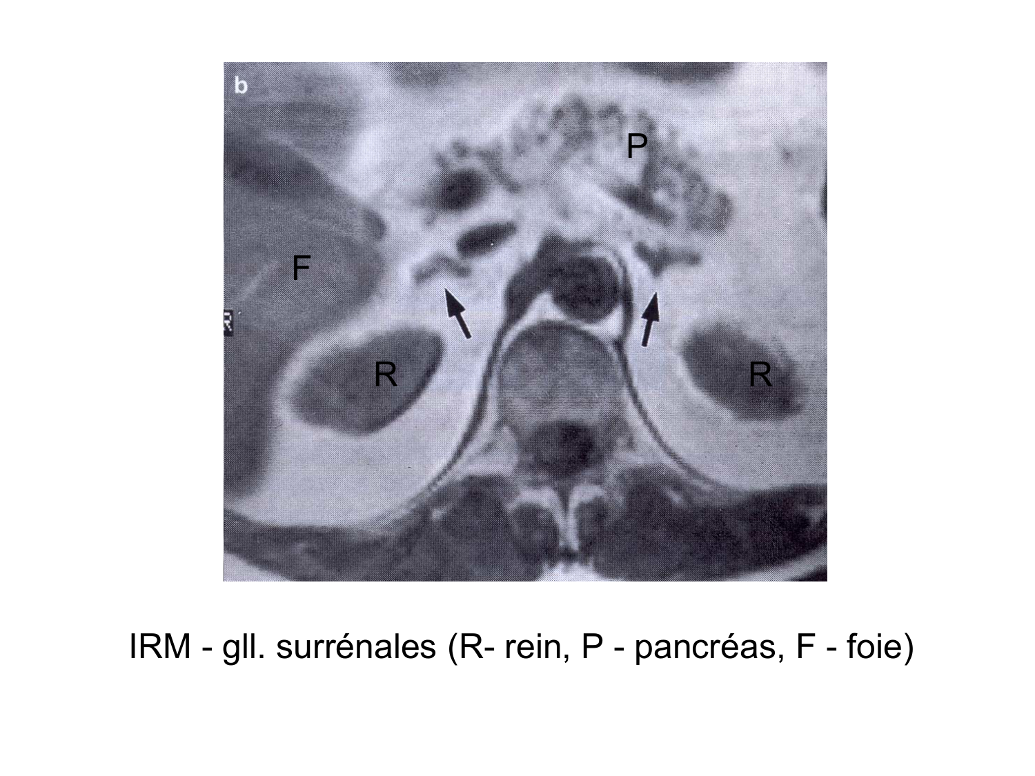 Anatomie du système endocrinien2 page 48