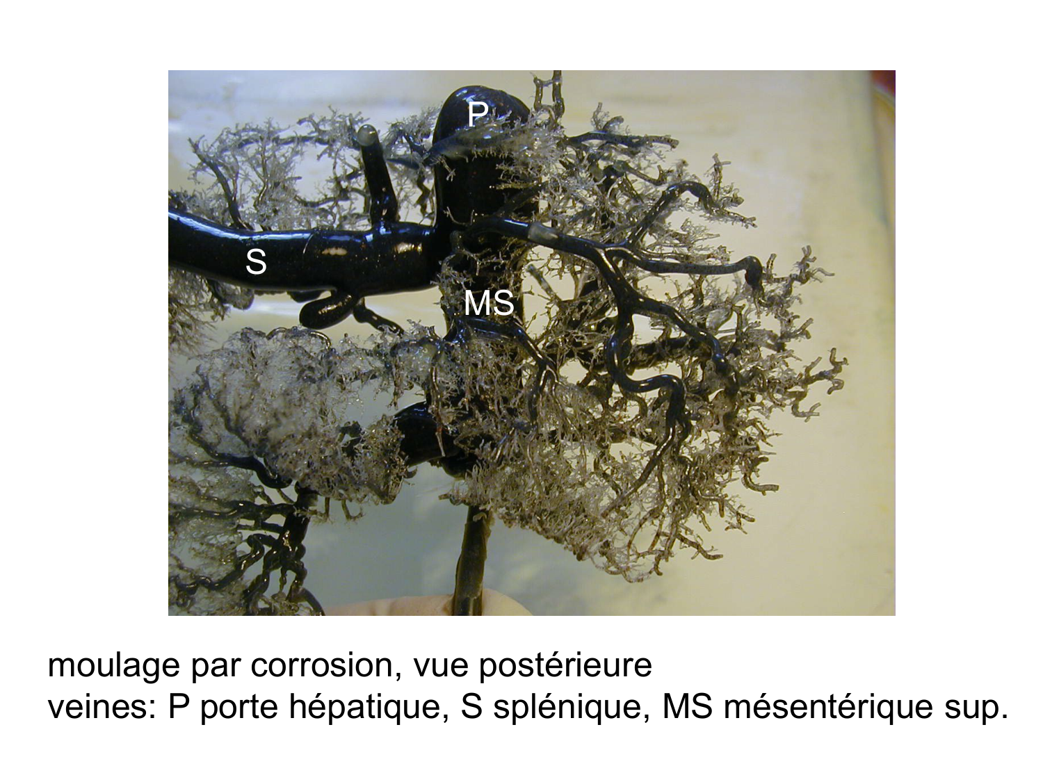 Anatomie du système endocrinien2 page 61