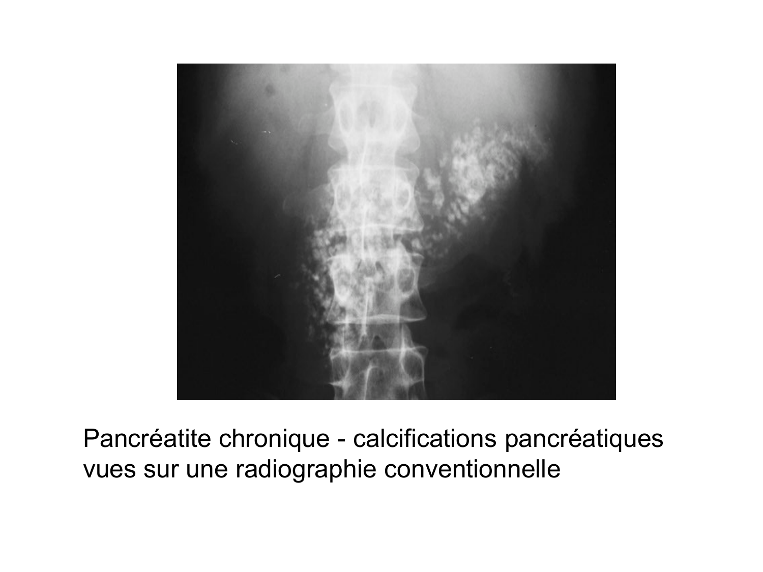 Anatomie du système endocrinien2 page 66