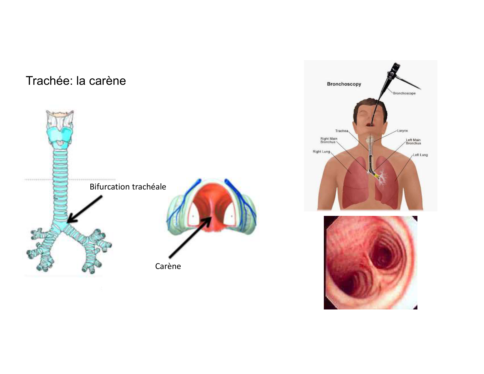 Anatomie pulmonaire 2025 2026 page 11