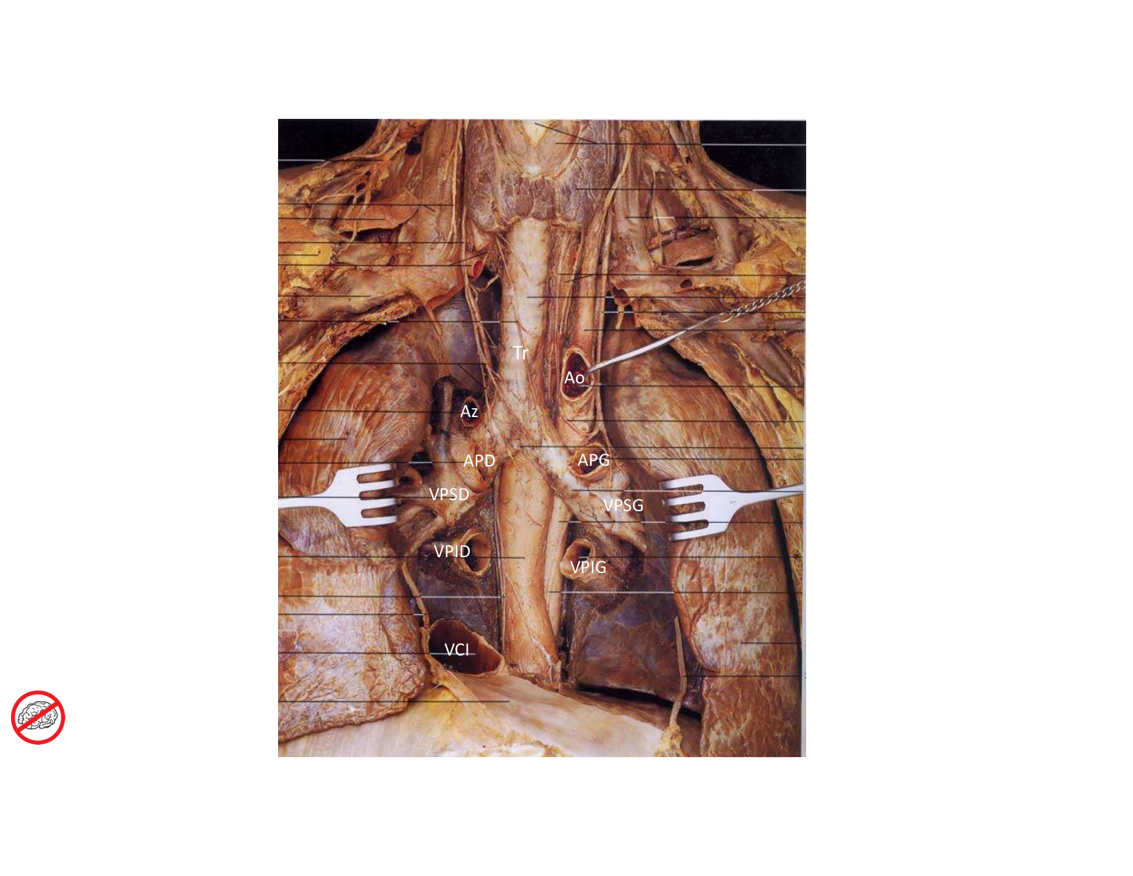 Anatomie pulmonaire 2025 2026 page 25