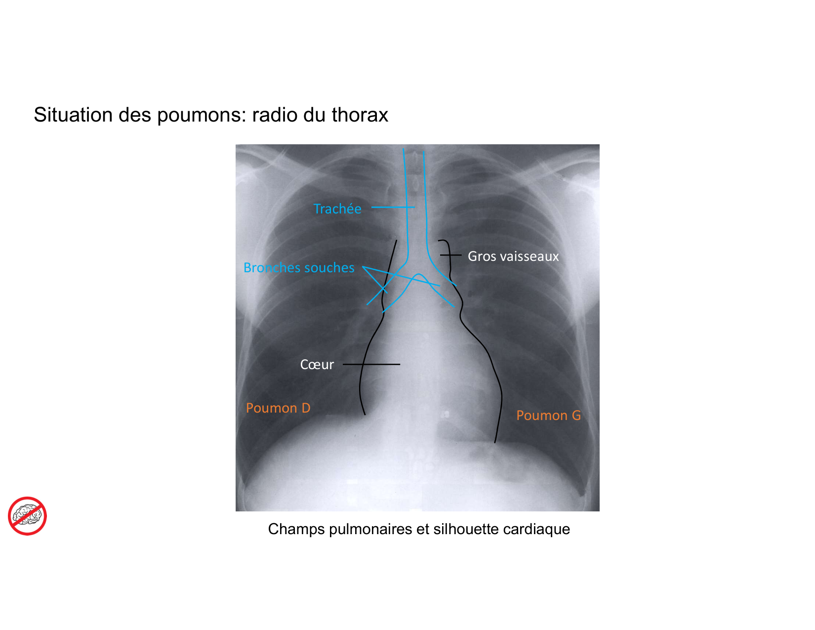 Anatomie pulmonaire 2025 2026 page 32