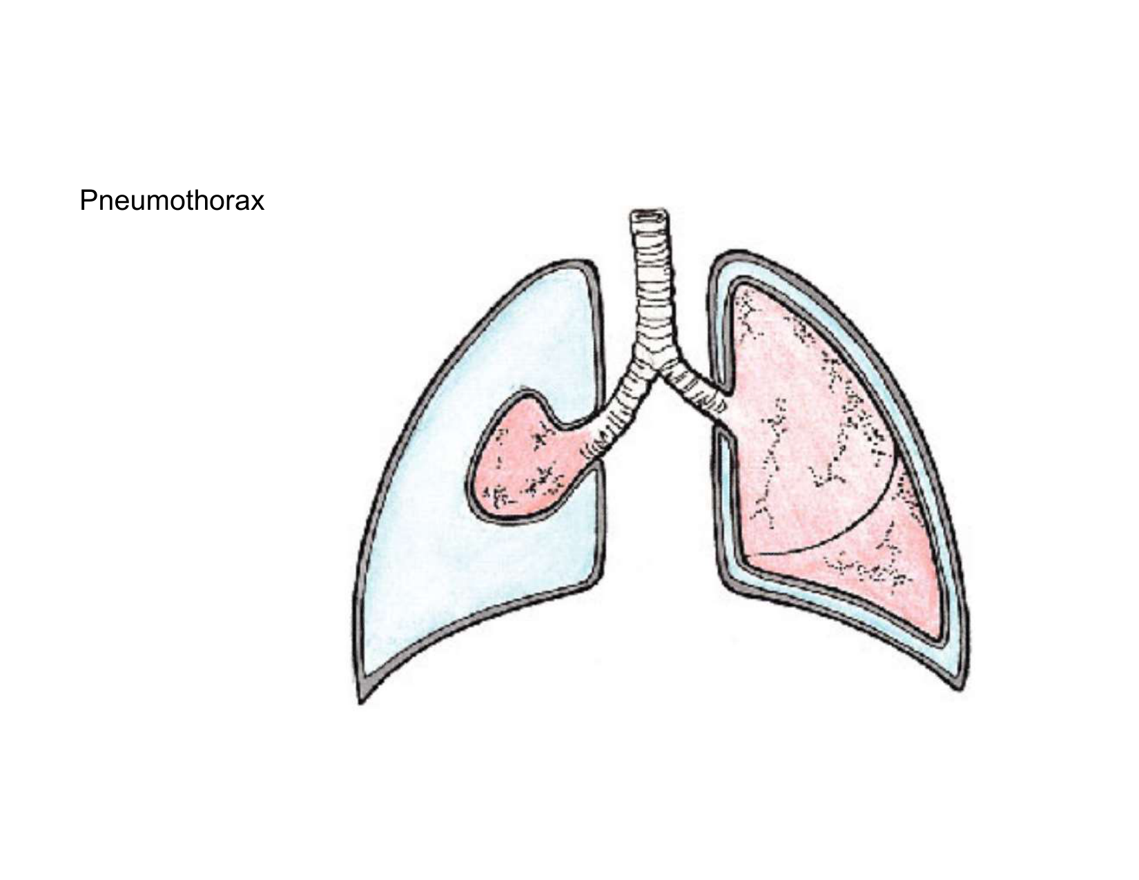 Anatomie pulmonaire 2025 2026 page 38