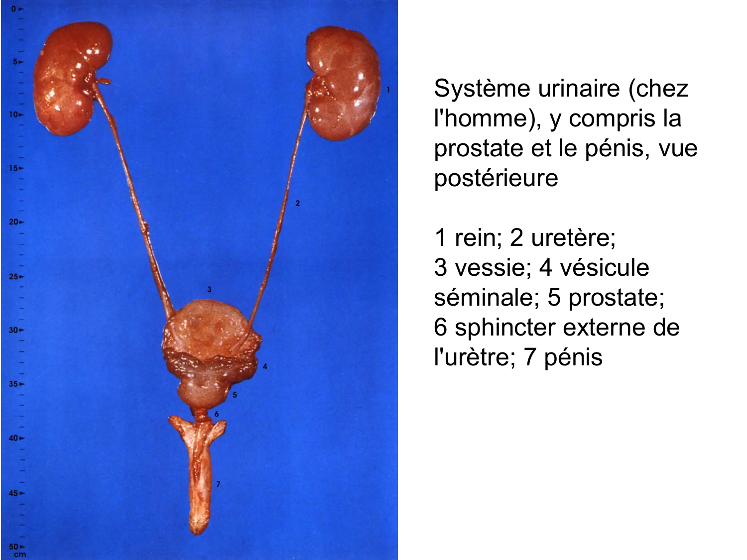Rein, voies urinaires et retropéritoine page 12