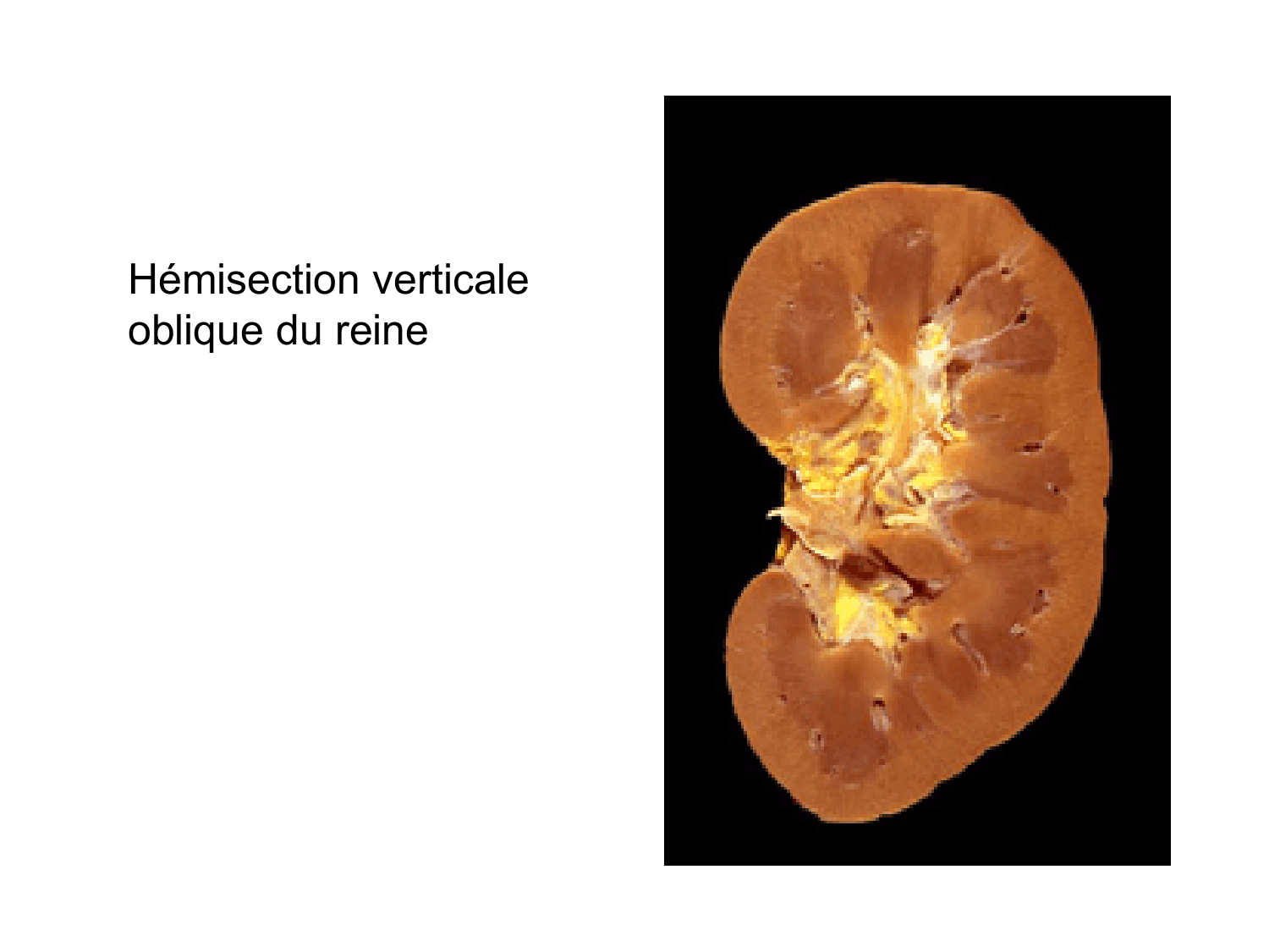 Rein, voies urinaires et retropéritoine page 21
