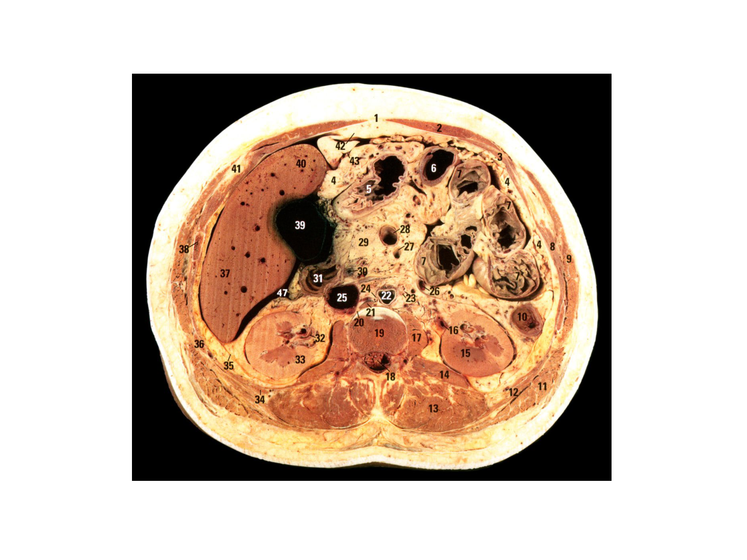 Rein, voies urinaires et retropéritoine page 34