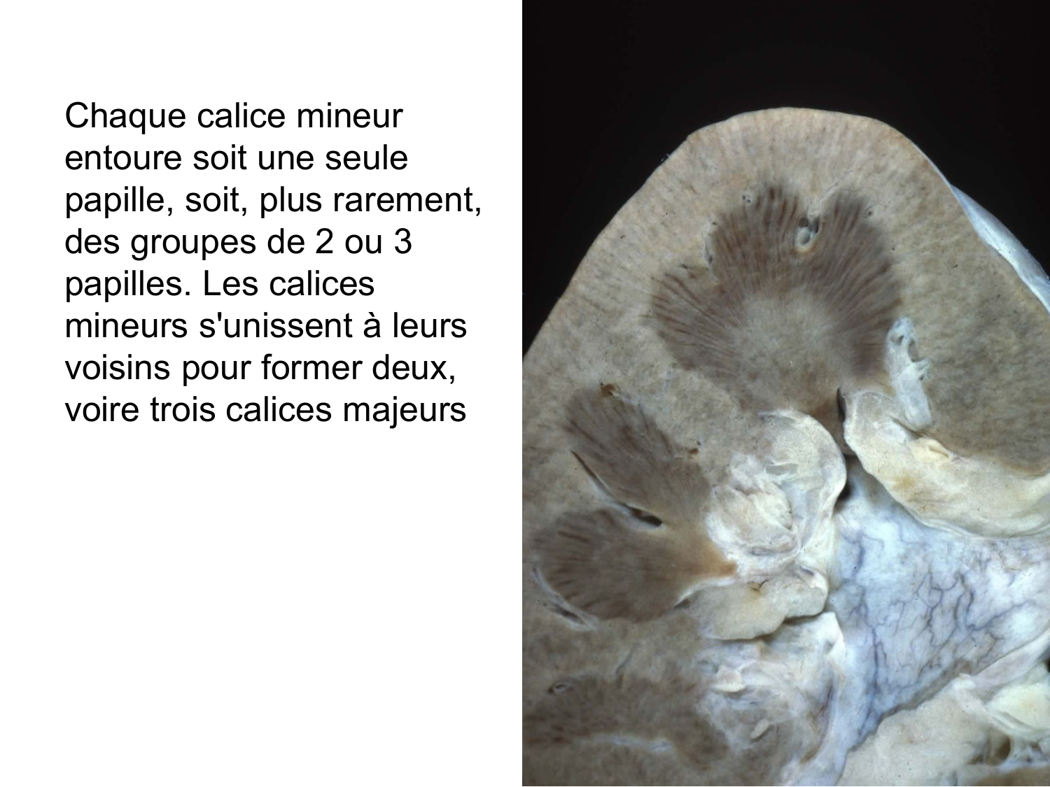 Rein, voies urinaires et retropéritoine page 42