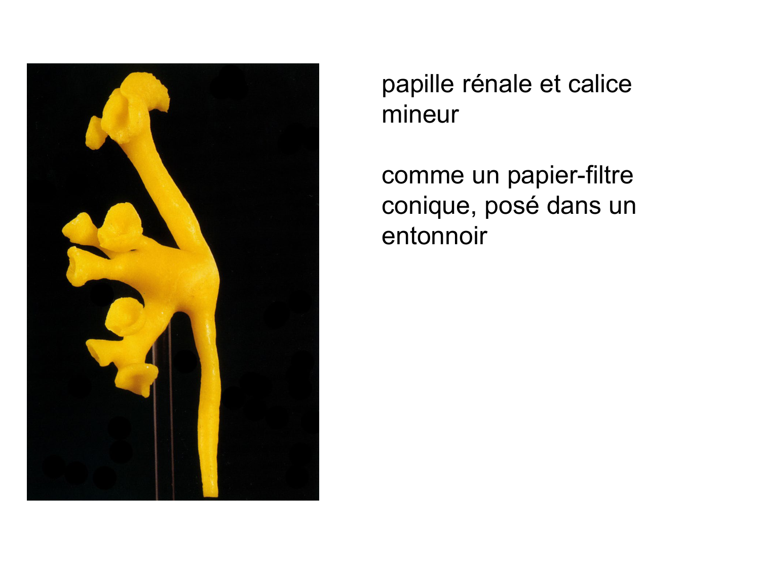 Rein, voies urinaires et retropéritoine page 43