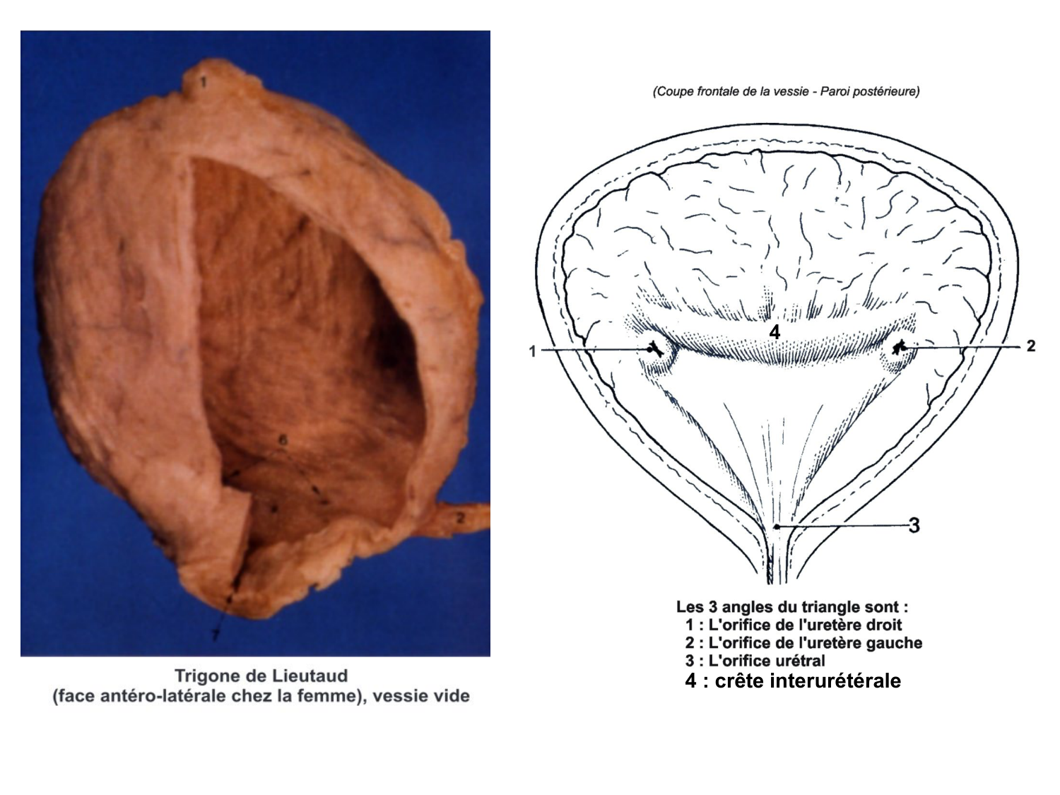 Rein, voies urinaires et retropéritoine page 65