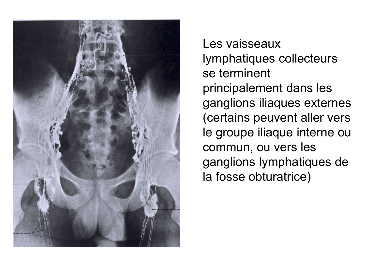 Rein, voies urinaires et retropéritoine page 66