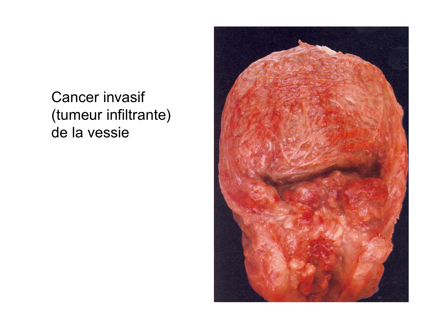 Rein, voies urinaires et retropéritoine page 75