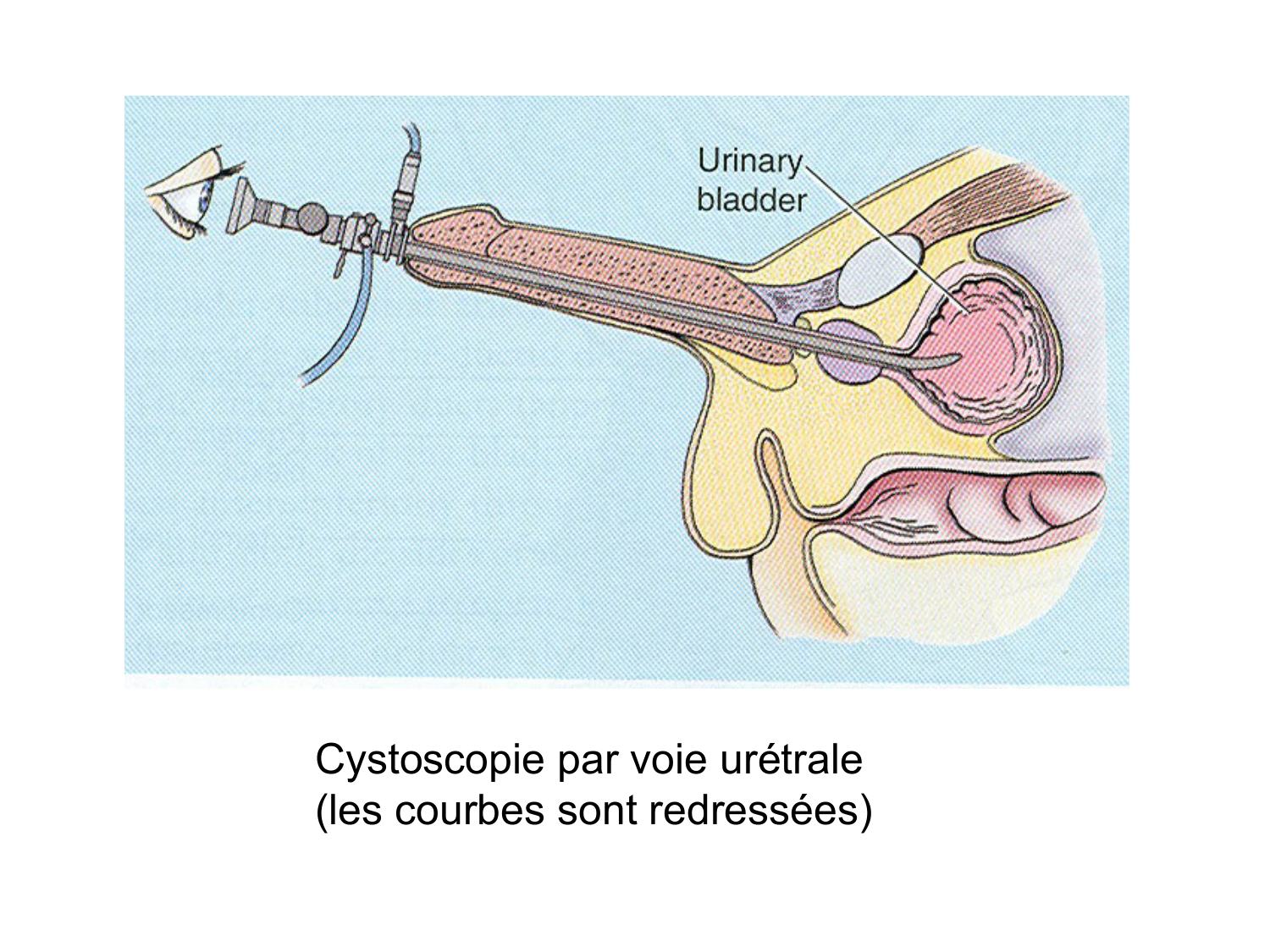 Rein, voies urinaires et retropéritoine page 82